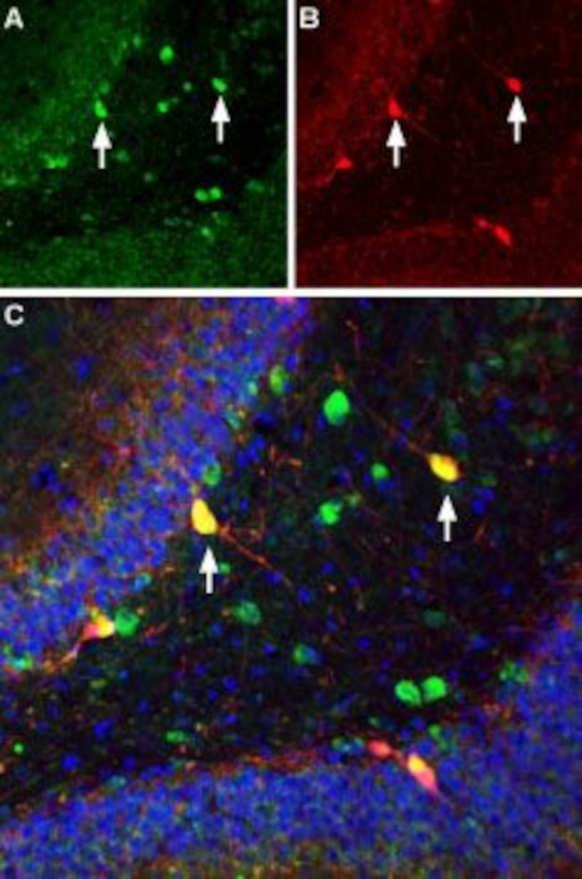 ASIC1 ANTIBODY