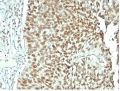 NUCLEOLIN