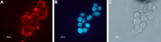 NICOTINIC ACETYLCHOLINE RECEPT