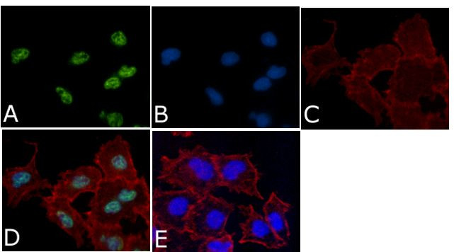 PHOSPHO-MEK1 THR292 PAB