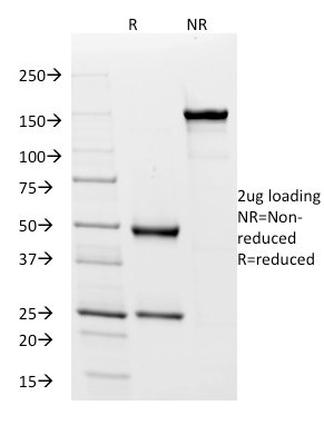 IGD (IMMUNOGLOBULIN DELTA HEAV