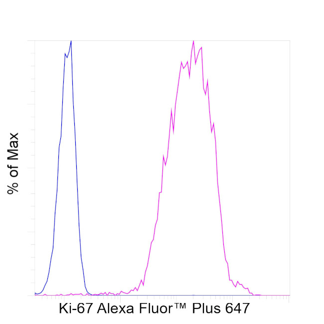 RT KI67 AFP647 RMAB