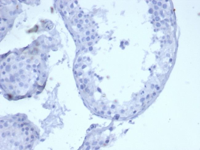 CYTOKERATIN 5 (KRT5)