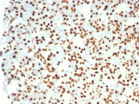 NUCLEOLIN (MARKER OF HUMAN CEL