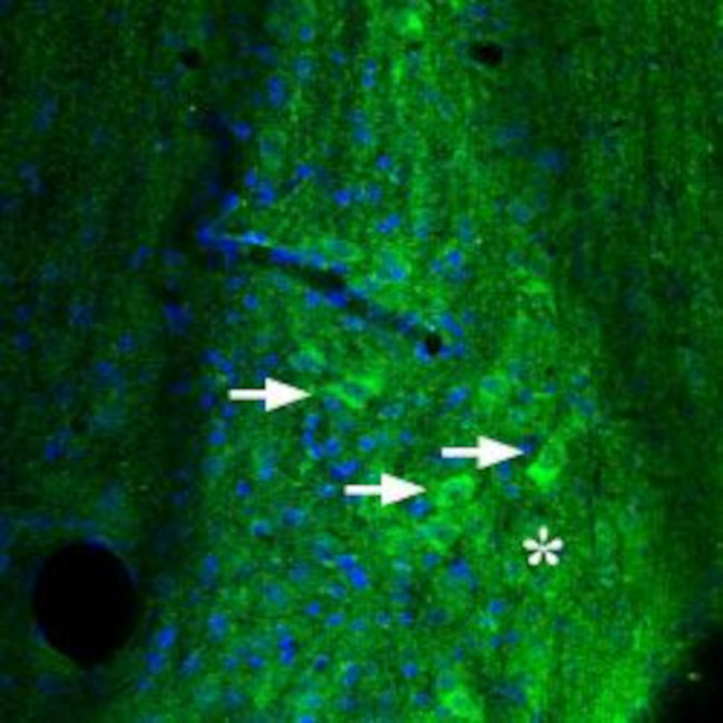 ADENOSINE A2A RECEPTOR ANTIBOD