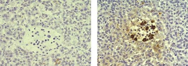 ANTI-SOMATOSTATIN ICDCLS PUR