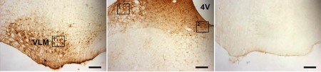 ASIC1 ANTIBODY