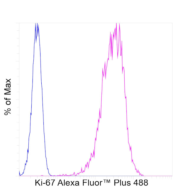 RT KI67 AFP488 RMAB