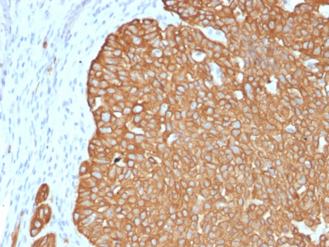 CYTOKERATIN 5 (KRT5)