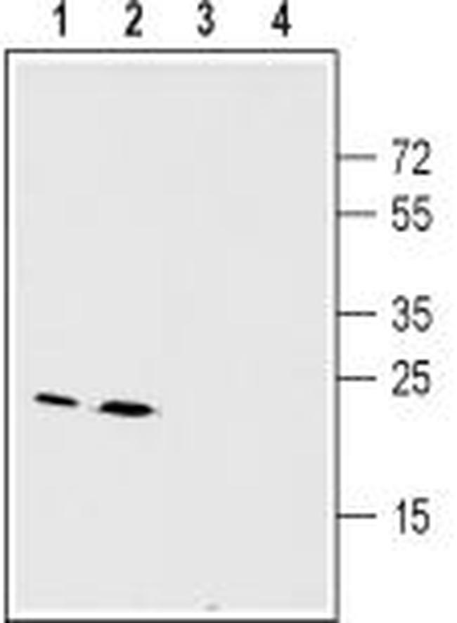 CONNEXIN-26 (GJB2) ANTIBODY