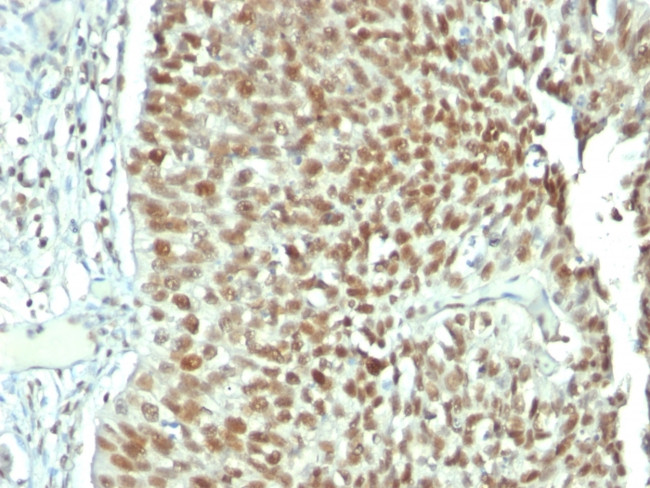 NUCLEOLIN