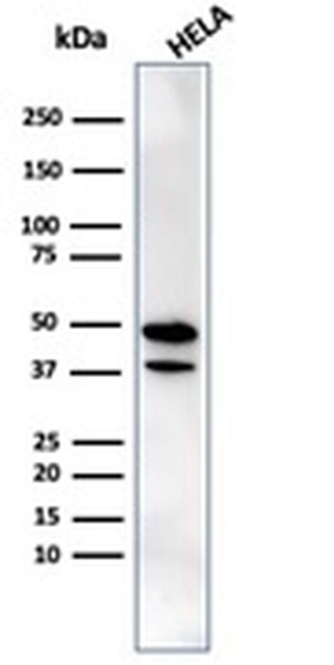 CREB5- CRE-BPA