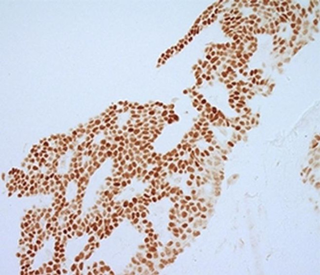 ESTROGEN RECEPTOR ALPHA ANTIBO