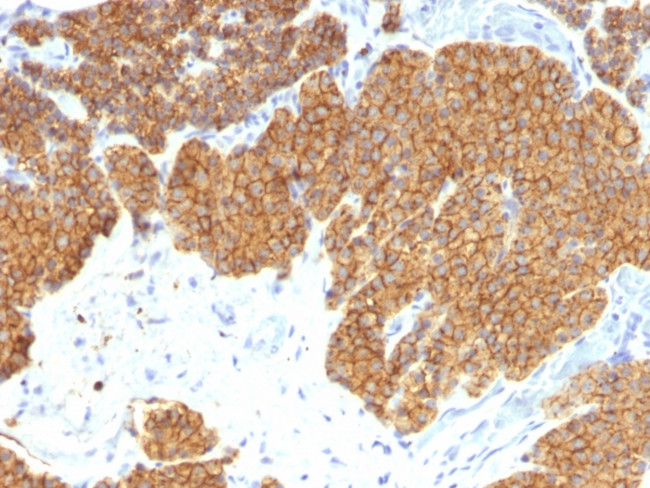 PARATHYROID HORMONE (PTH) (N-T