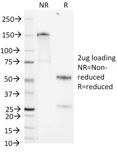 HEPARAN SULFATE PROTEOGLYCAN (