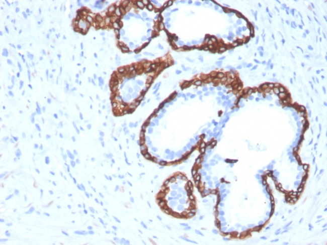 CYTOKERATIN 5 (KRT5)