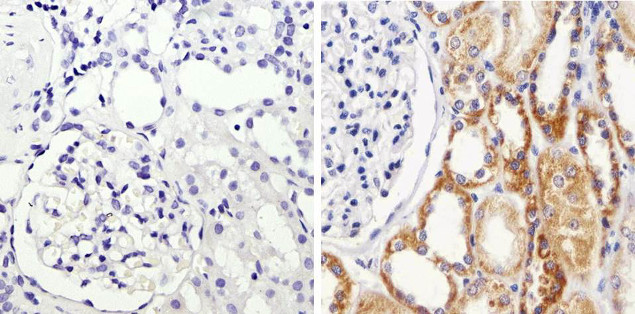 IKB ALPHA ANTIBODY