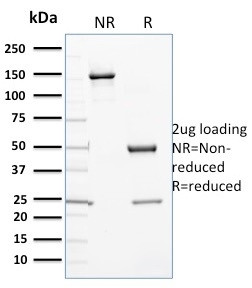 CYTOCHROME P450 3A1/CYP3A1 ANT
