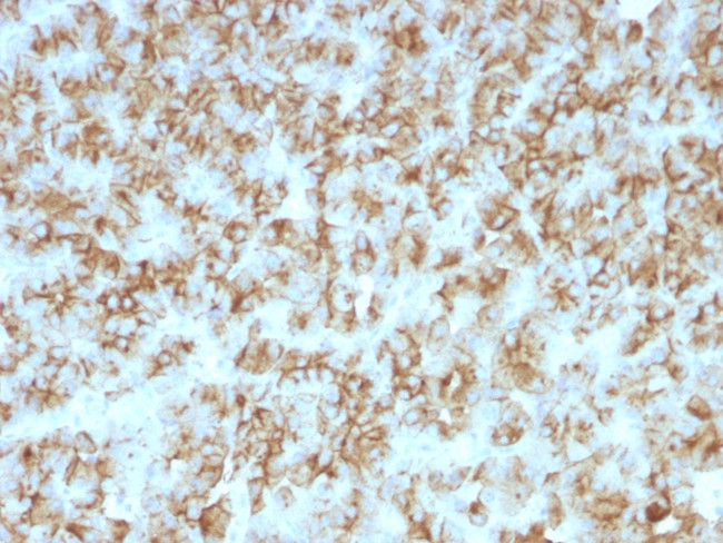 PARATHYROID HORMONE (PTH) (N-T
