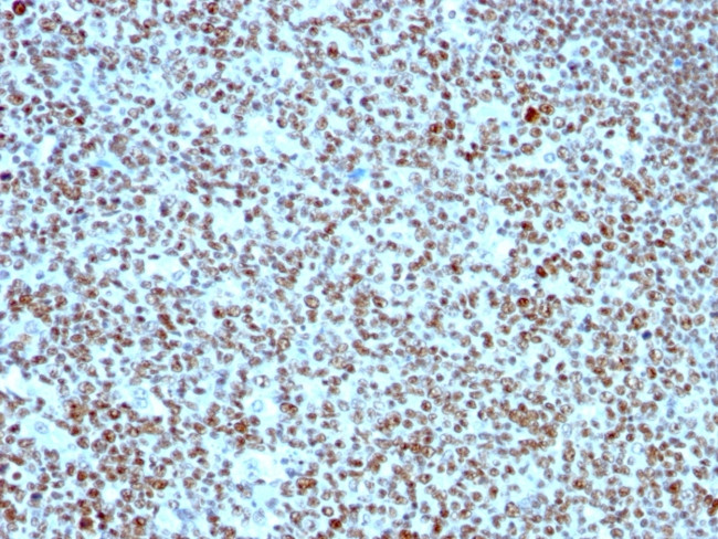 NUCLEOLIN (MARKER OF HUMAN CEL