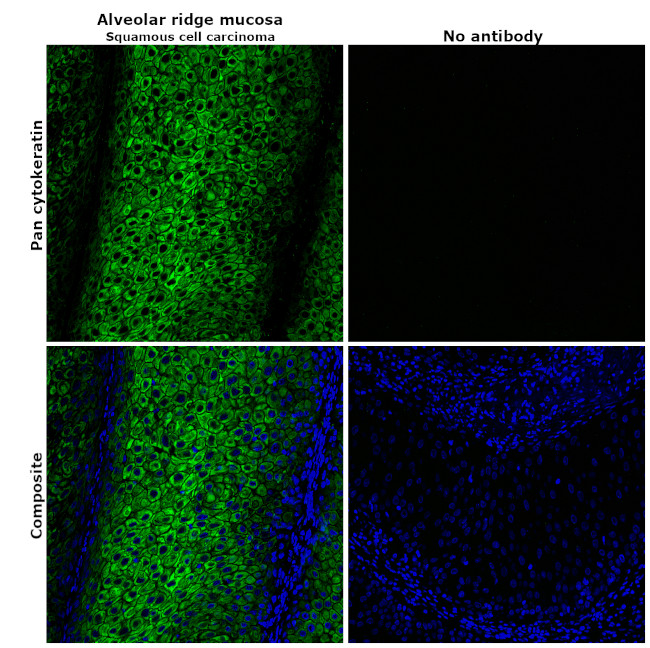 ANTI-PAN CYTOKERATIN AF488 MAB