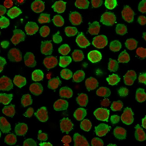 CALPONIN-1 (SMOOTH MUSCLE MARK