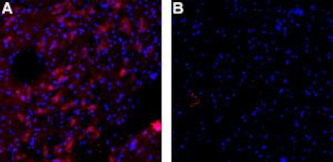 KCNN3 (KCA2.3- SK3) ANTIBODY A