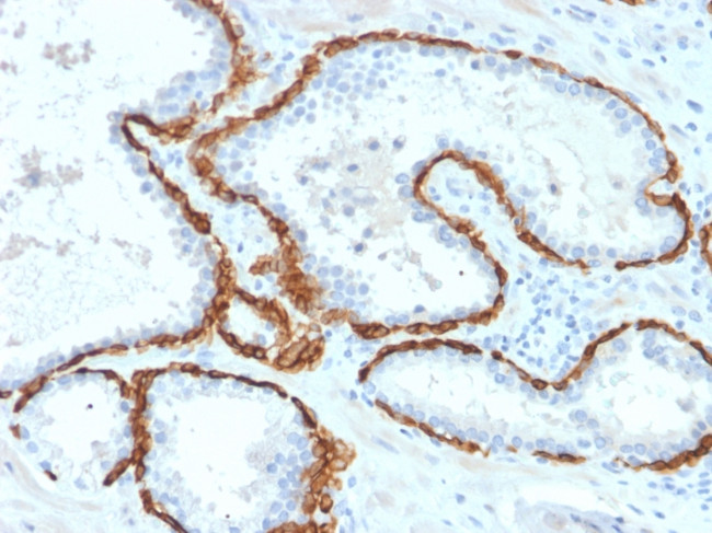 CYTOKERATIN 15