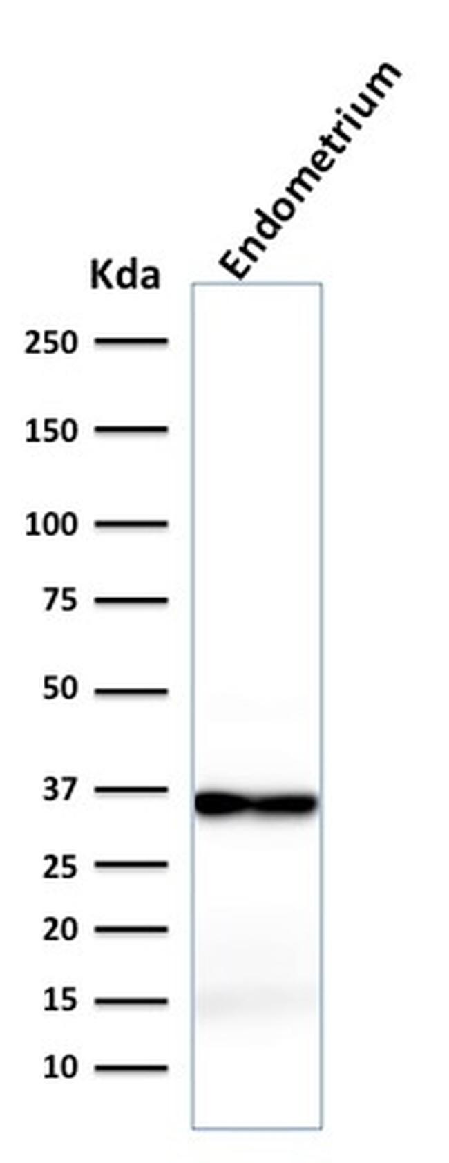 CALPONIN-1