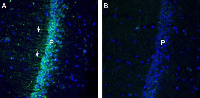 KCNN1 (KCA2.1- SK1) ANTIBODY