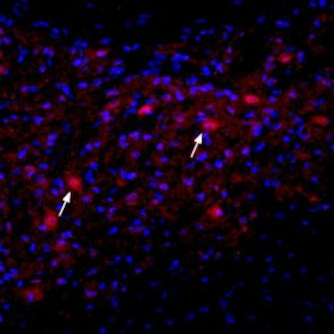 NICOTINIC ACETYLCHOLINE RECEPT