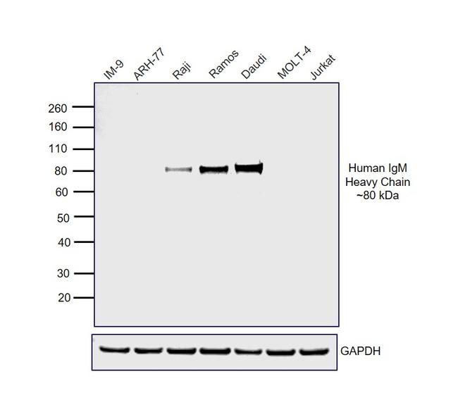 GOXHU IGM HRP
