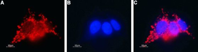 CONNEXIN-26 (GJB2) ANTIBODY