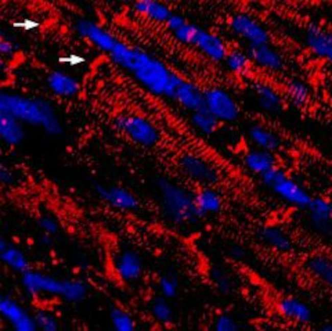 NAV1.5 (SCN5A) ANTIBODY