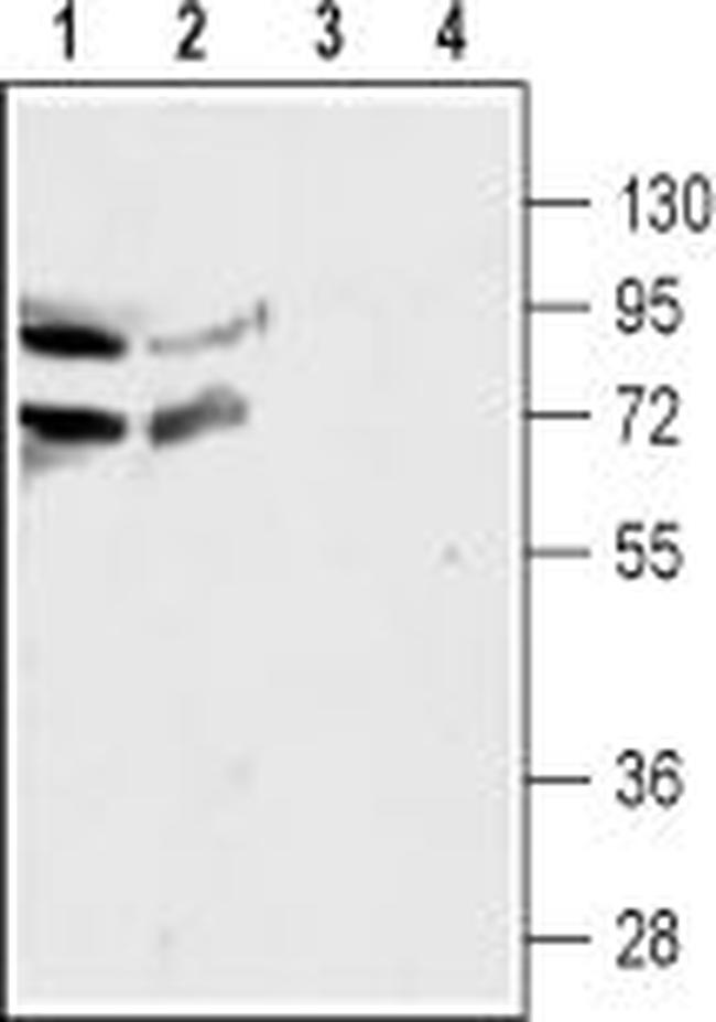 NICOTINIC ACETYLCHOLINE RECEPT