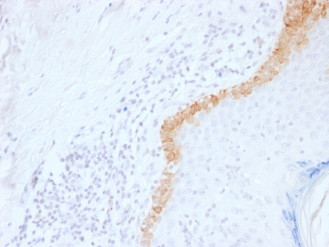CYTOKERATIN 15 (ESOPHAGEAL SQU