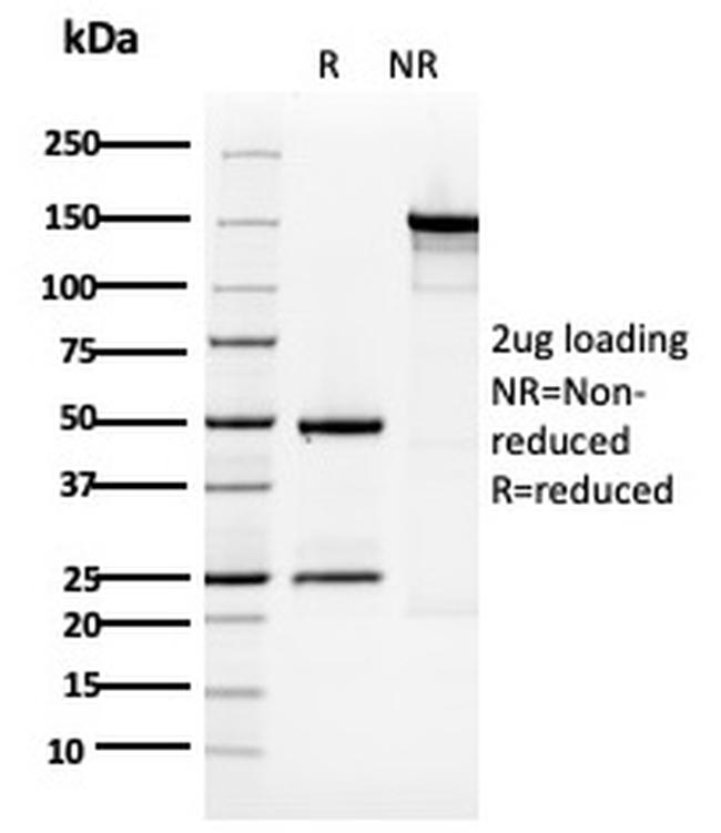 CYTOKERATIN 5 (KRT5)