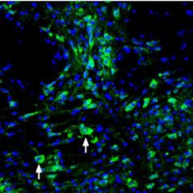 ASIC3 ANTIBODY