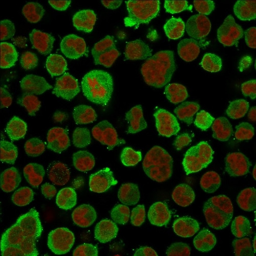 CALPONIN-1 (SMOOTH MUSCLE MARK