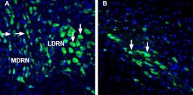 LYNX1 (EXTRACELLULAR) ANTIBODY