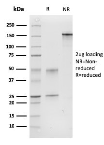 CALPONIN-1 (SMOOTH MUSCLE MARK