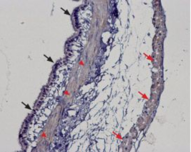 TRPM2 ANTIBODY