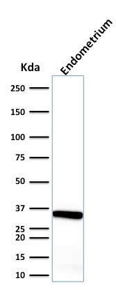 CALPONIN-1 (SMOOTH MUSCLE MARK