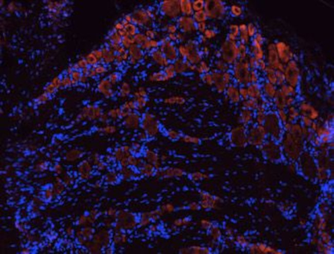 TRKB (EXTRACELLULAR) ANTIBODY