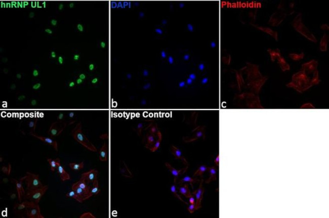 ANTI-HU HNRNP UL1 EAP 4A11 PUR