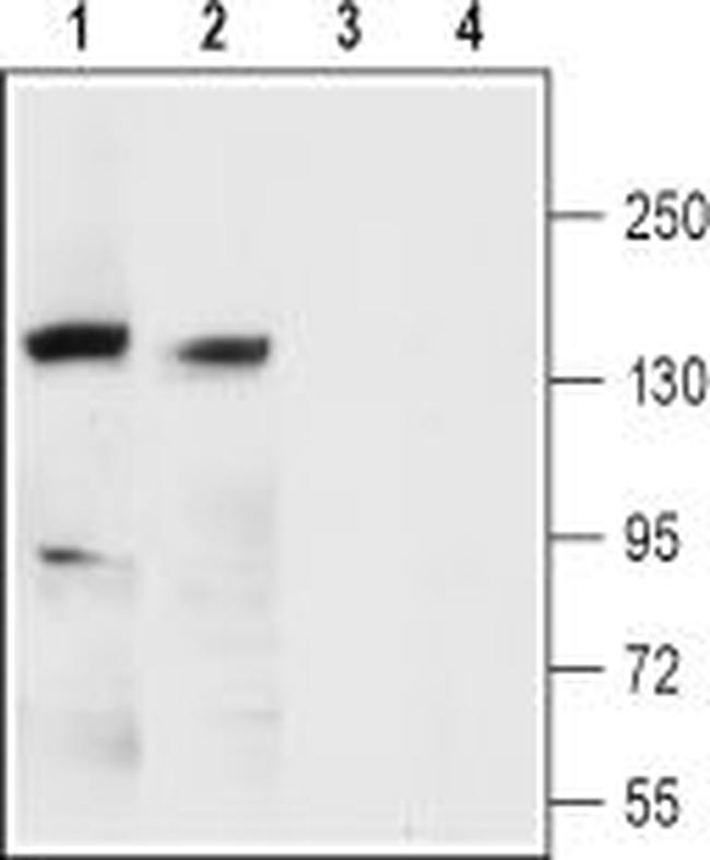 KCNMA1 (KCA1.1) (EXTRACELLULAR