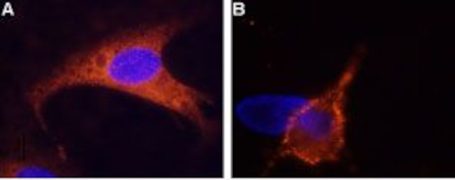 TRPM8 (EXTRACELLULAR) ANTIBODY
