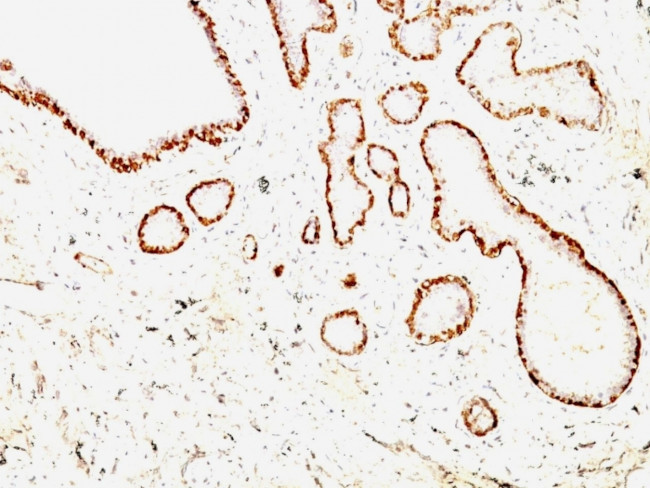CALPONIN-1 (SMOOTH MUSCLE MARK