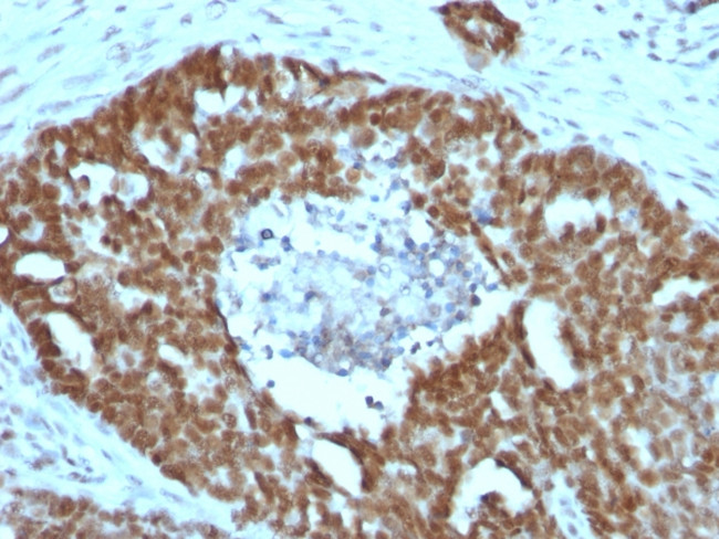 NUCLEOLIN