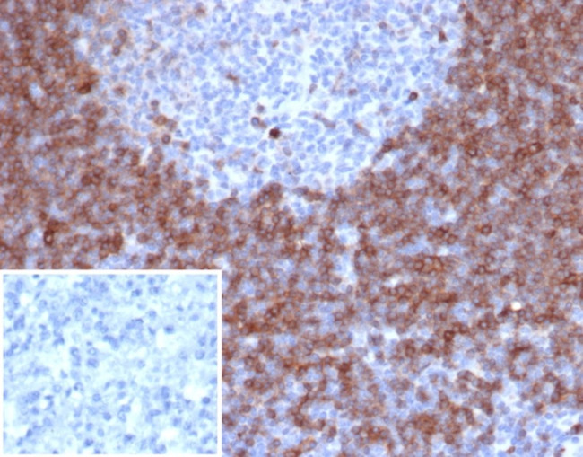 IGD (IMMUNOGLOBULIN DELTA HEAV